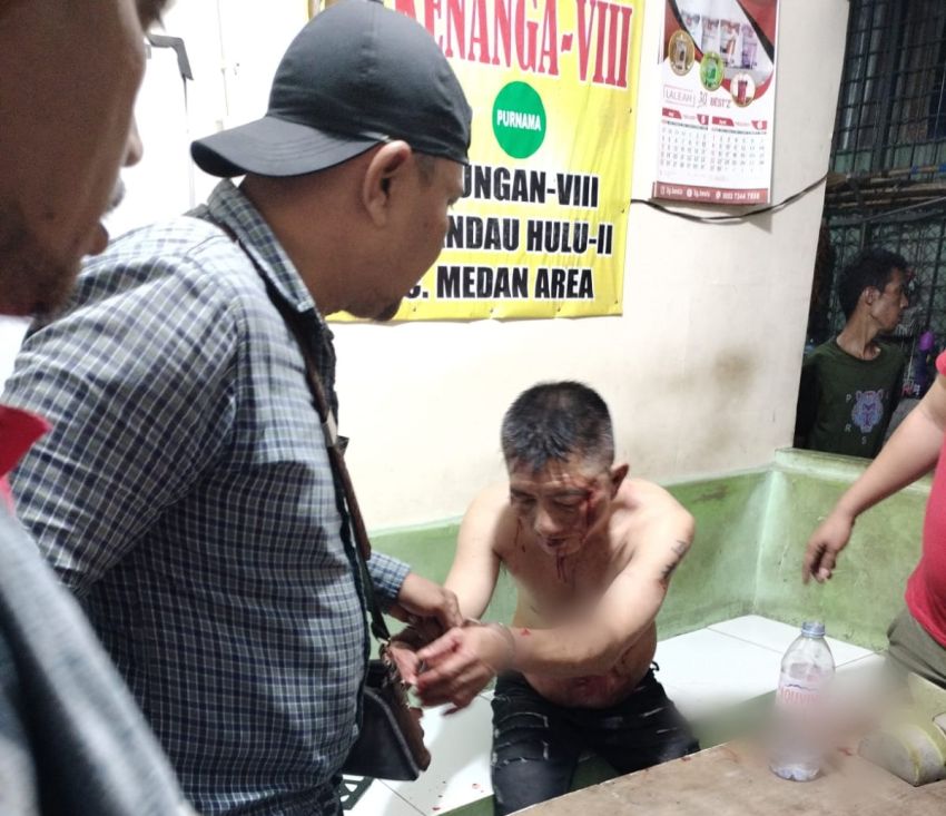 Polisi Ungkap Motif Suami Bunuh Istri di Medan Area, Tikam Istri Hingga 24 Kali