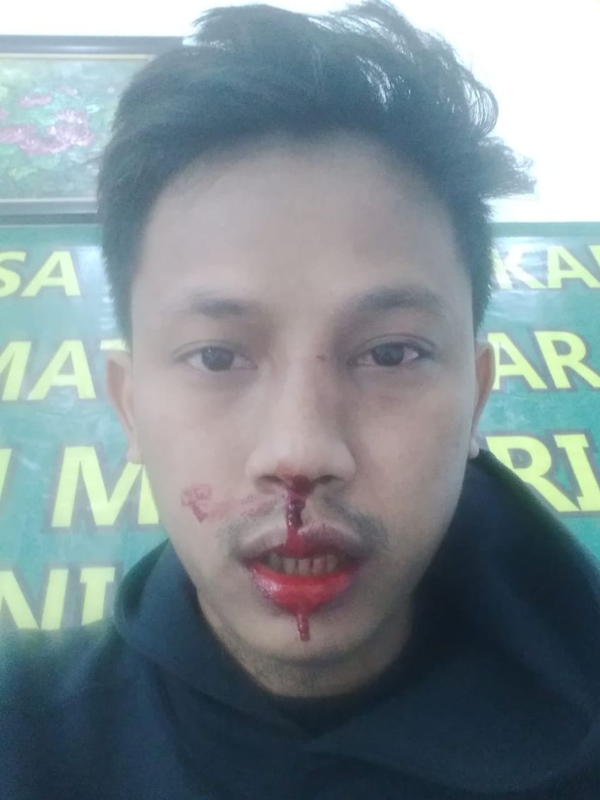 Aksi Demo di Kejatisu: Mahasiswa Dibogem Hingga Berdarah, Kapolda Sumut Harus Mengusut