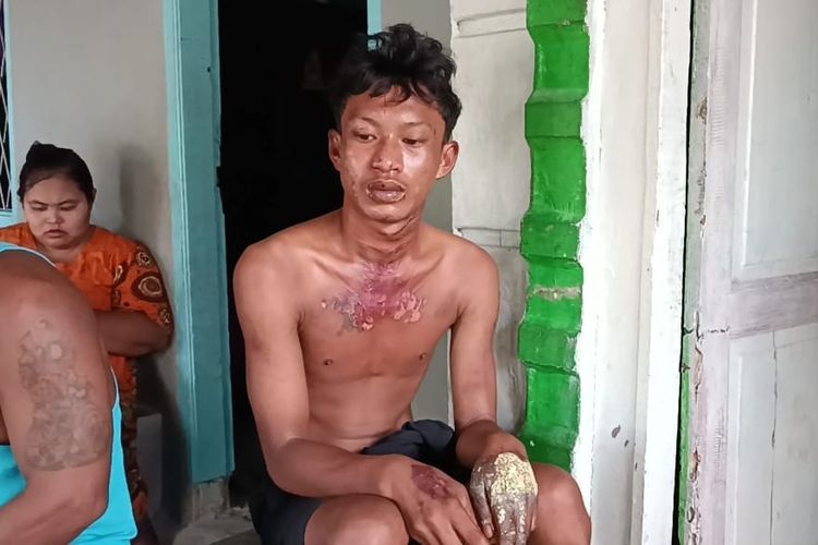 Begini Nasib Oknum PNS dan Brimob yang Aniaya dan Bakar Maling Ubi di Bandar Klippa