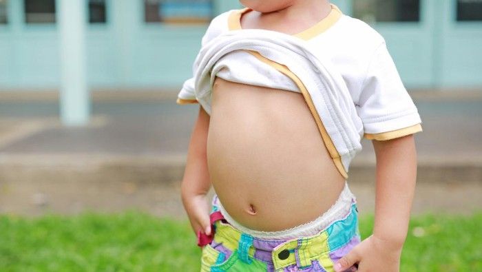 Anak-anak di Sumut Banyak Mengalami Cacingan, Apa Penyebabnya?