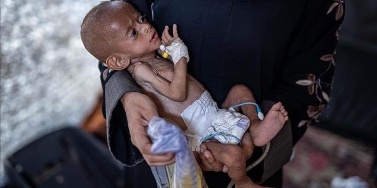 Memilukan! Anak-anak Gaza yang Kelaparan Terlalu Lemah untuk Menangis...