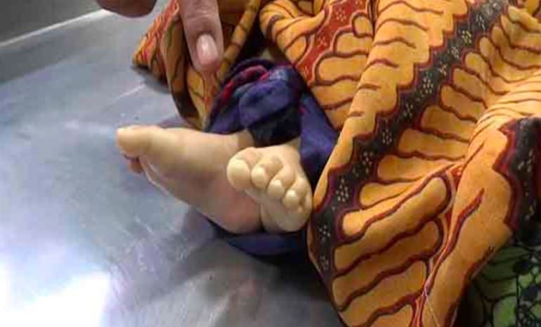 Keji, Pria di Tapsel Banting Anak Tiri Berkali-kali hingga Tewas