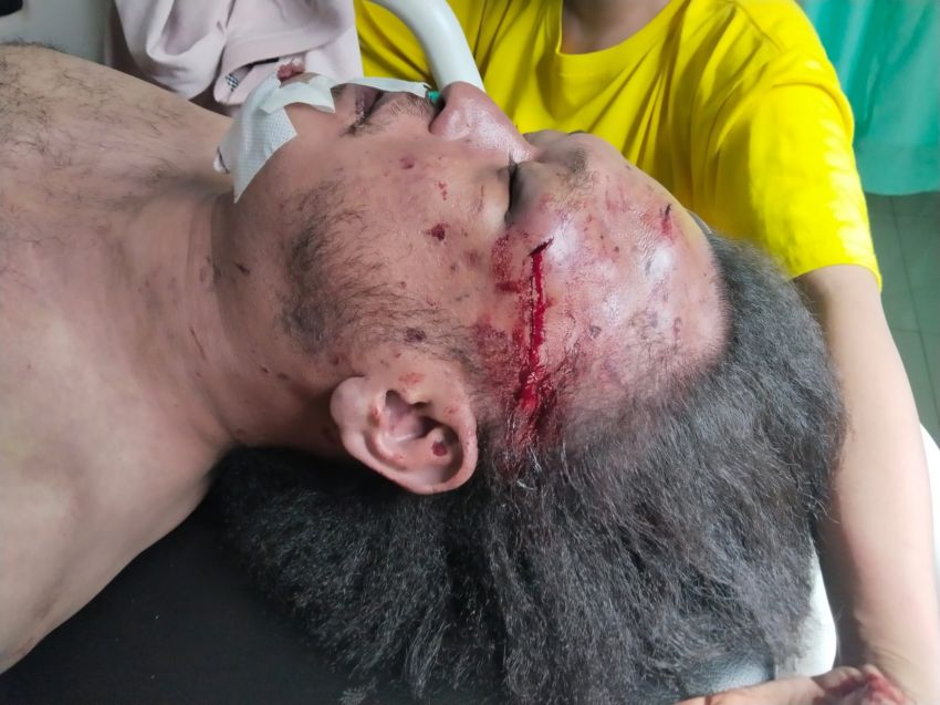 Diduga Korban Pembunuhan, Wartawan di Medan Tewas di Kamar Mandi Kosnya