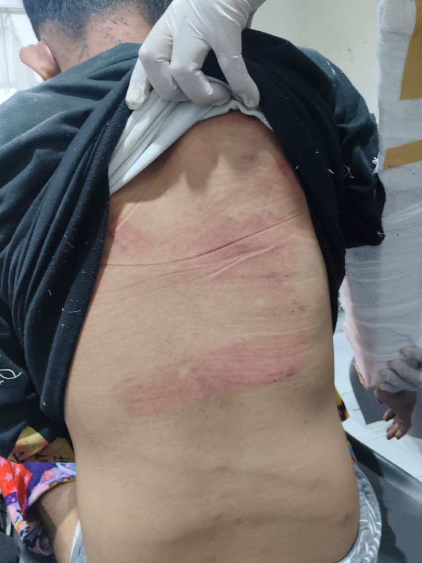 Ryanvaldo Joshua Tambunan Disiksa Tanpa Ampun oleh Ayah Pacar Bersama Orang Suruhan