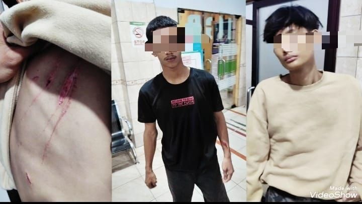 Gemot Beraksi, 2 Pelajar di Binjai Diculik dan Disabet Senjata Tajam