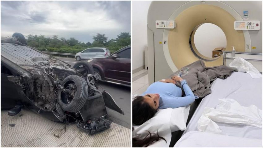 Model Diva Siregar Kecelakaan di Jalan Tol, Mobil City Hancur