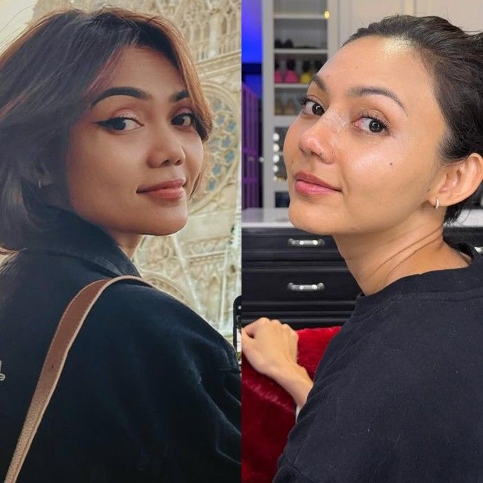 Bikin Pangling, Lihat Penampilan Rina Nose Sesudah Operasi Hidung