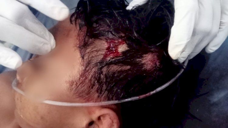 Remaja 17 Tahun Tewas Diduga Jadi Korban Tawuran