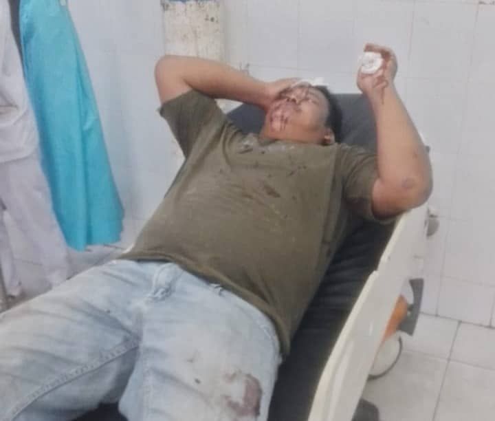 Bentrokan Berdarah di Lahan Sengketa 366 Hektare di Asahan, Sejumlah Warga Luka Berat