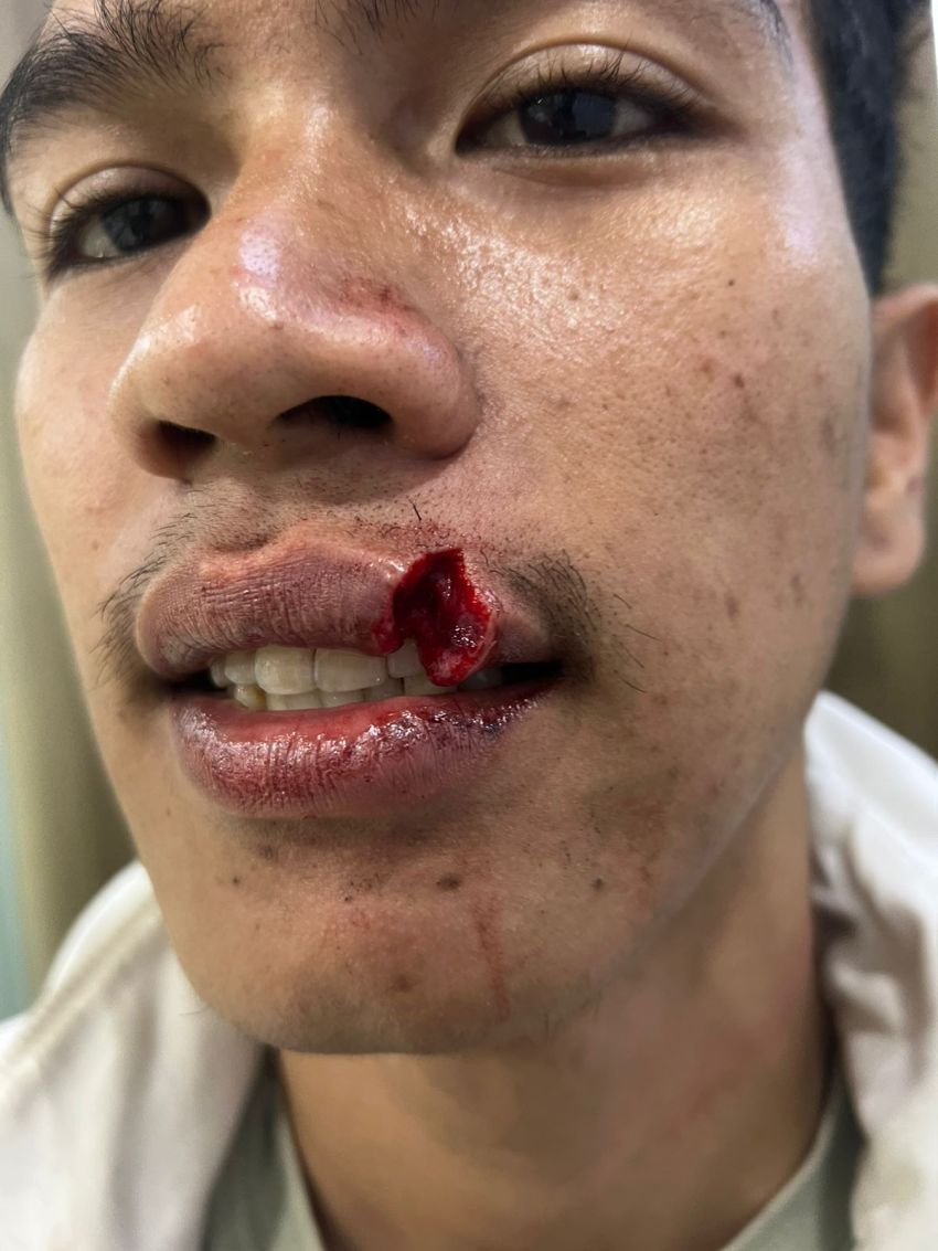 Korlap Parkir Pasar Sukaramai Dikeroyok Sekelompok Preman, Tubuh Memar dan Bibir Pecah