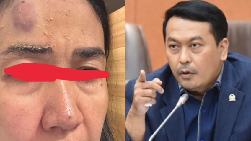Terusik, Rudi Hartono Bangun Mulai " Ancam" Mantan Istri, " Habis Nanti Kubuat"