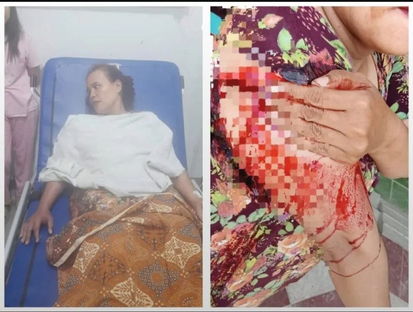 Begal Siang Bolong di Medan Marelan, Ibu Penjual Pecal Disabet Parang