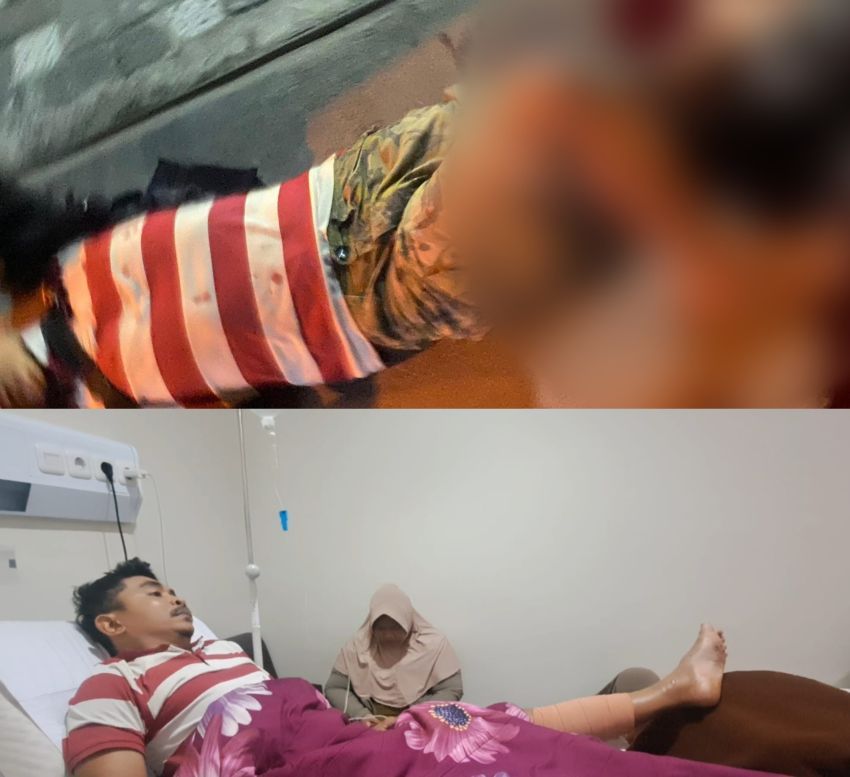 Tukang Giling Bakso Dibacok Kawanan Geng Motor