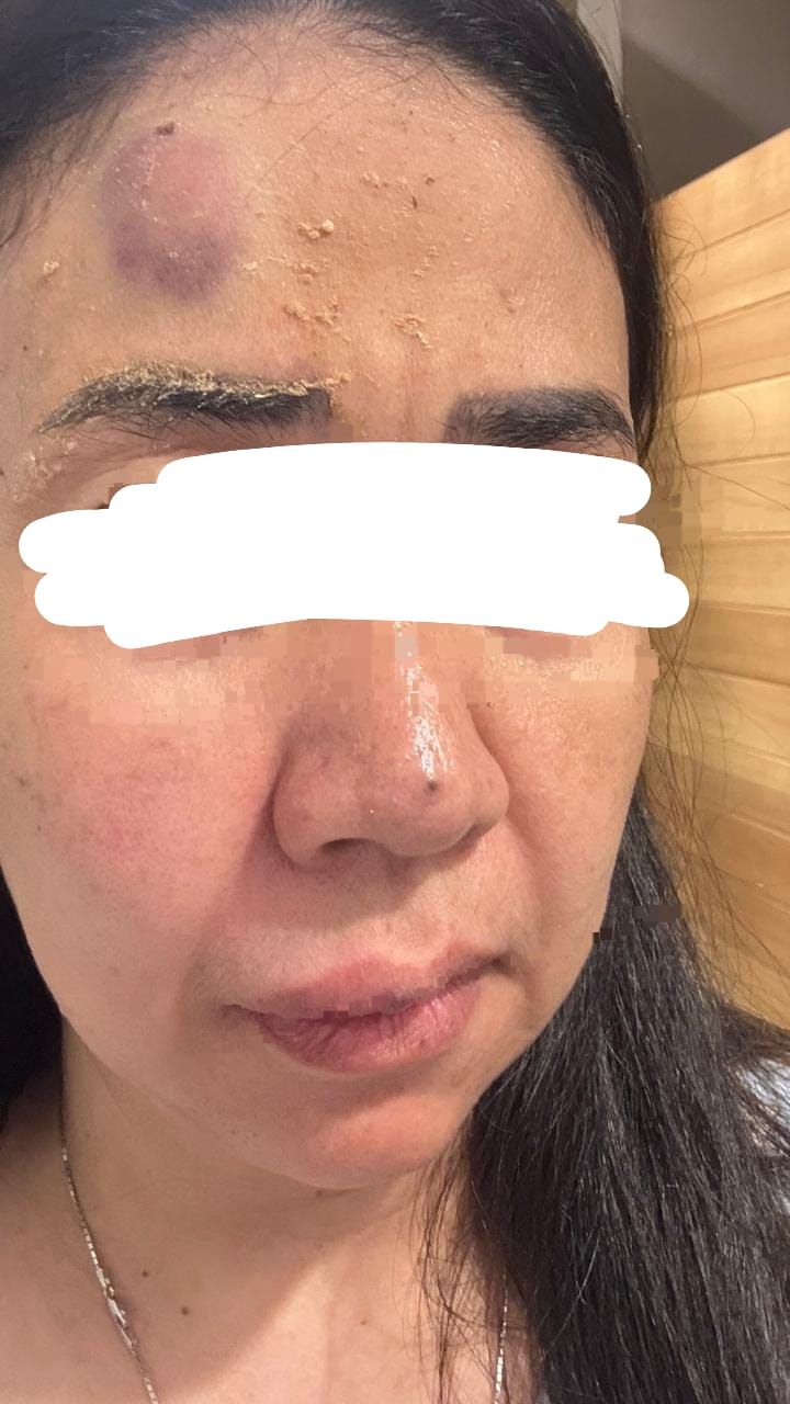 Oknum Anggota DPR RI Diduga Aniaya Mantan Istri, MKD Diminta Bertindak