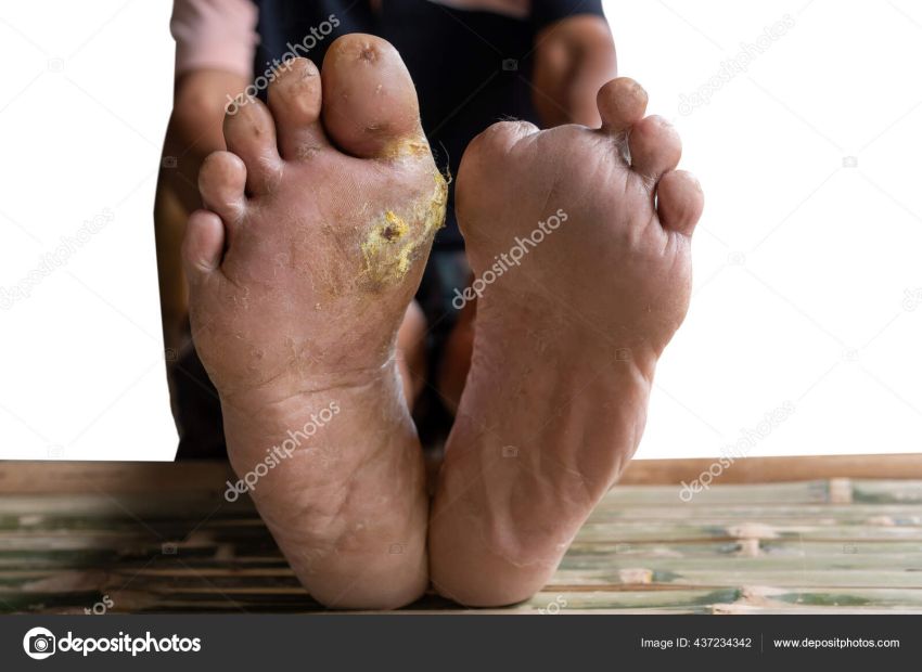 Alamak! Potongan Kaki Diduga Bekas Operasi Dibuang di Sungai Deli