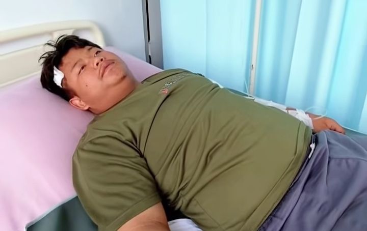 Tangan Siswa SMA Dikelewang Begal di Binjai Barat, Pelakunya 3 Orang