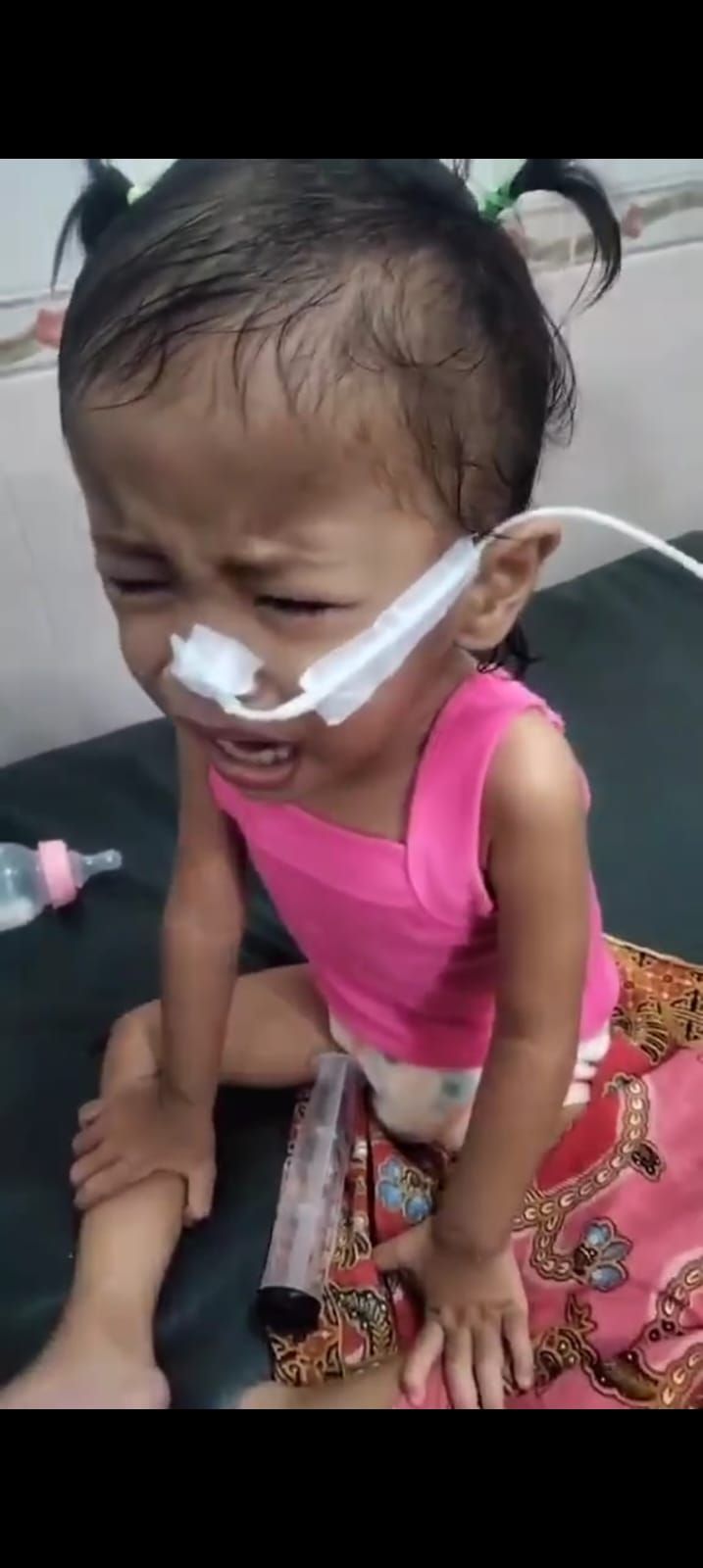 Arisha Bertarungan Melawan Penyakit, Dua Tahun Hidup dengan Jantung Bocor dan Sesak Napas