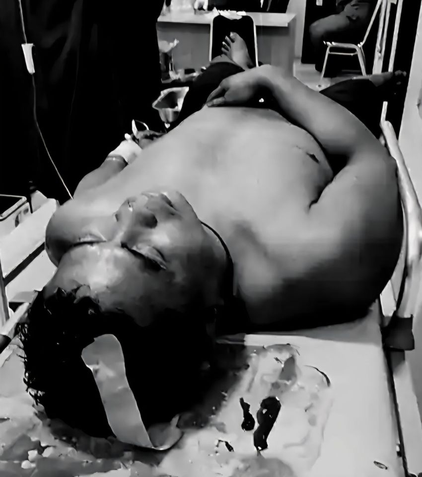 Ngeriii...Warga Jermal Dianiaya Hingga Babak Belur, Pelakunya Diduga Kelompok Preman