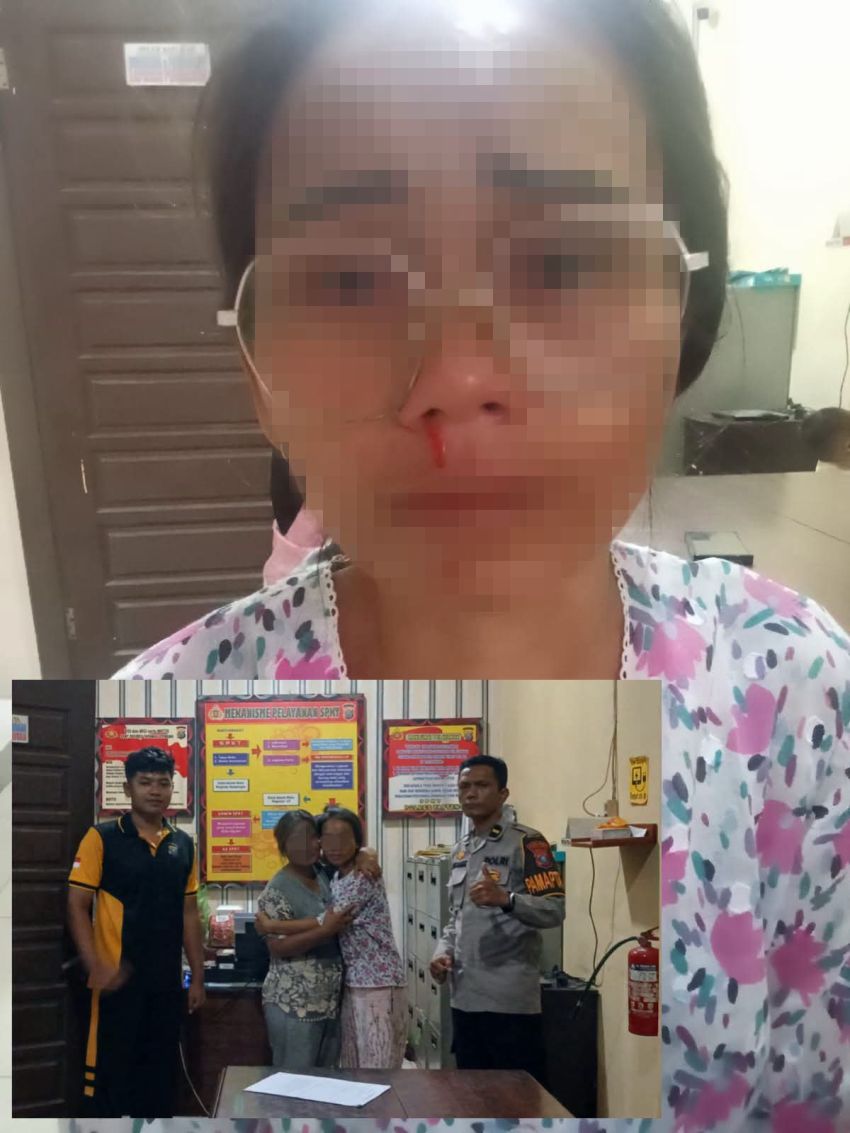 Keponakan di Tapanuli Tengah Dianiaya Tante Kandung