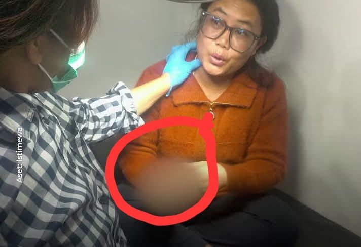Cekcok Hingga Jari Tengah Boru Saragih Putus Digigit, Seorang IRT Terpaksa Diamankan Polres Dairi