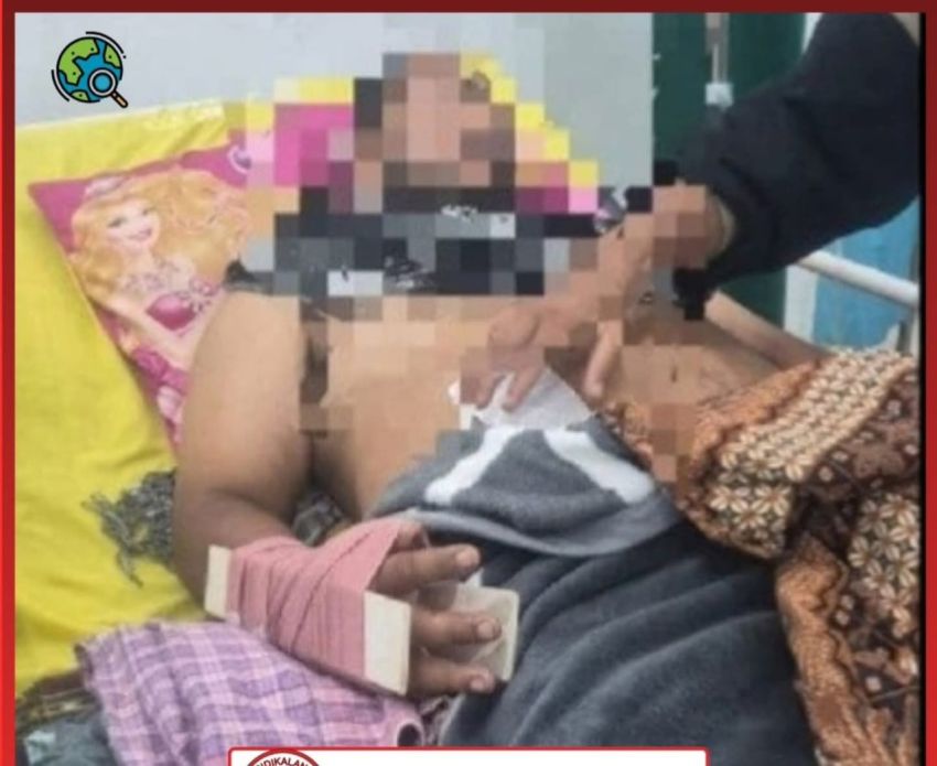 Duh... Tangan Abang Nyaris Putus Ditebas Parang, Pelaku Adik Kandung Sendiri