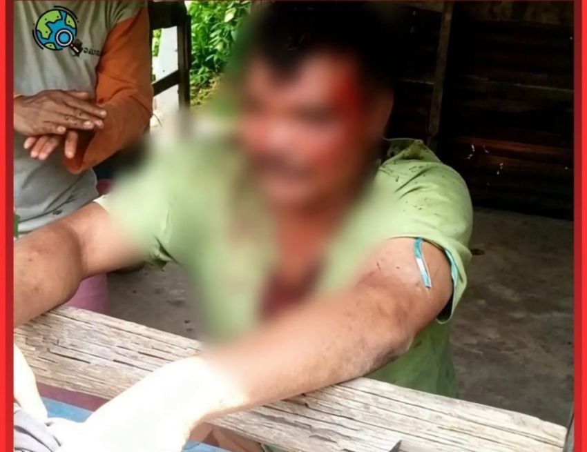 Diduga Dikeroyok 3 Orang, Pria di Sumbul Dairi Menderita Luka Serius