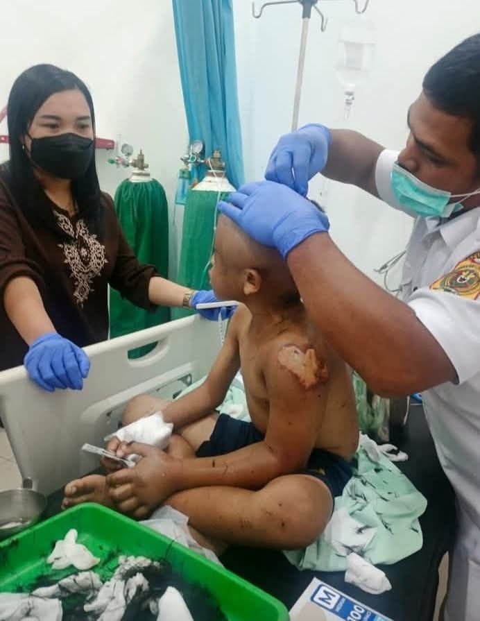 Bikin Miris! Bocah Laki-laki di Dairi Babak Belur Disiksa Pengasuhnya
