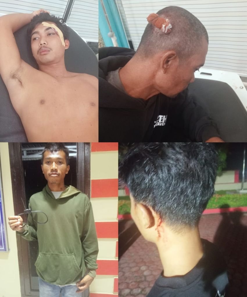 Dikeroyok Satpam PT BSP, Empat Warga Terluka, Ada yang Ngaku Digari